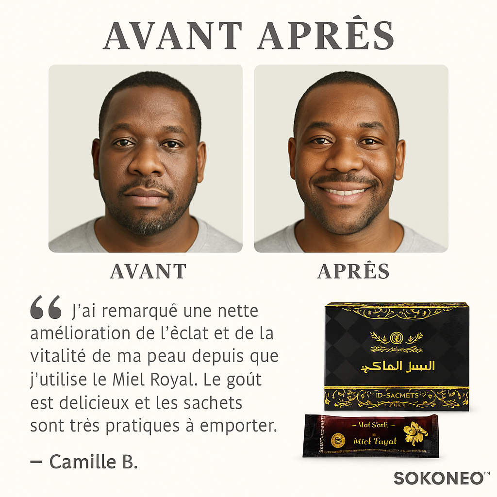 Sokoneo™ Miel Royal_ML