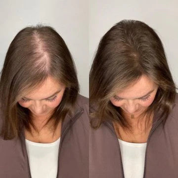 Sokoneo™ Accélérateur de Croissance des Cheveux_ML