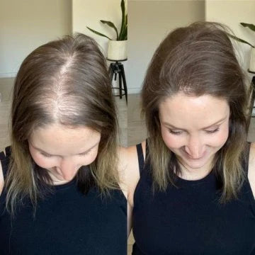 Sokoneo™ Accélérateur de Croissance des Cheveux_ML