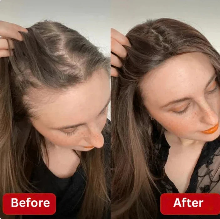 Sokoneo™ Accélérateur de Croissance des Cheveux_ML