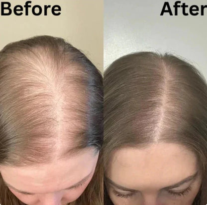 Sokoneo™ Accélérateur de Croissance des Cheveux_ML